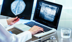 Doctor reviewing mammography results on pc.