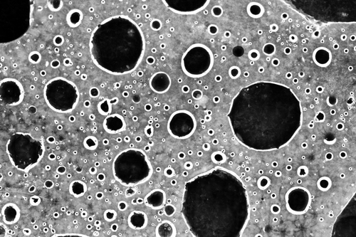 Cancer cells. Photo: Depositphotos.com