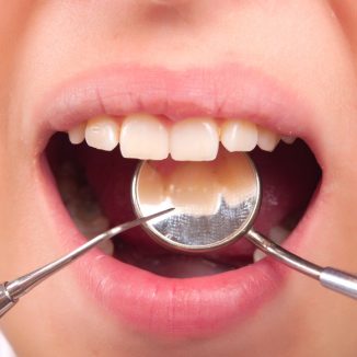New in Amsterdam: walk-in emergency dentist Dental365