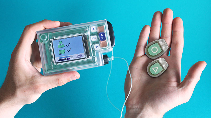 Artificial pancreas offers hope to type 1 diabetes sufferers - DutchNews.nl